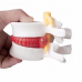 Demonstrate of Disc of Bone